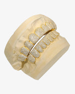 Custom Moissanite Diamond Grillz 14K Yellow Gold - 